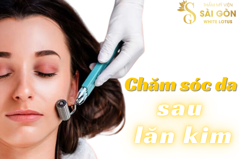 Chăm sóc da sau lăn kim