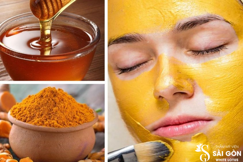 Mặt nạ thiên nhiên nghệ + mật ong